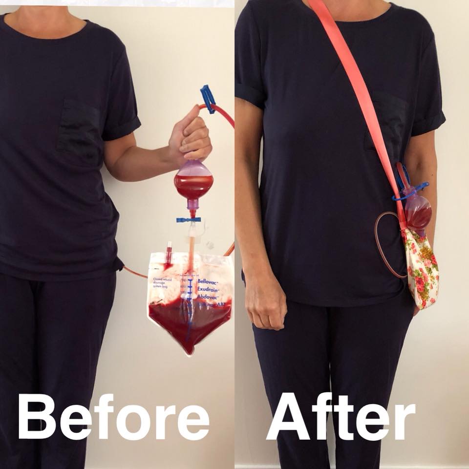 Drain Bag for post surgery mastectomy cancer care
